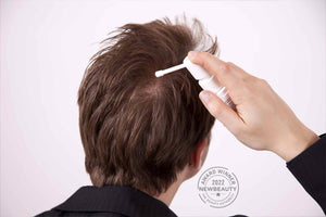 Unlocking the Potential: Understanding the Role of Minoxidil in Hair Growth Cycle