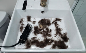 Innovative Therapies for Hair Growth What’s on the Horizon
